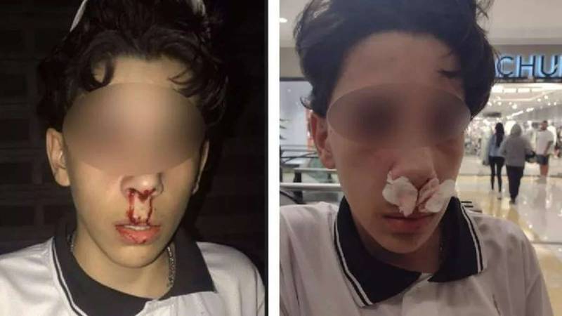 Vídeo: menino de 14 acusa segurança de shopping por agressão em SP. “Ele acertou na minha cara, e eu apaguei”, relata o adolescente