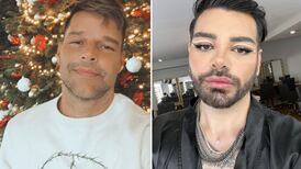 Ficou parecido? Argentino realiza mais de 30 cirurgias para se parecer com Ricky Martin 