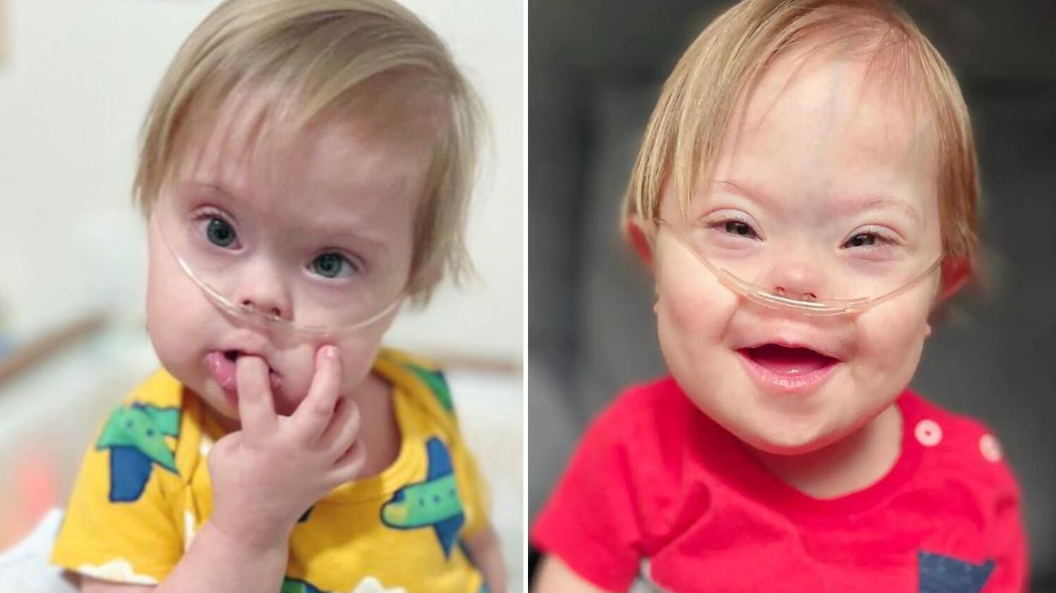 Ele lutava contra desafios da Síndrome de Down