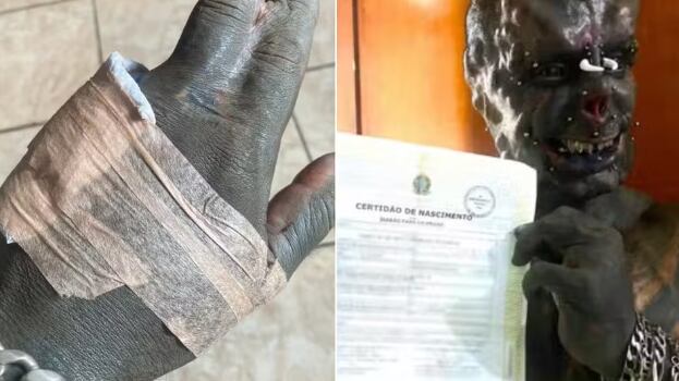 Tatuador Diabão fez nova modificação extrema e retirou um dedo