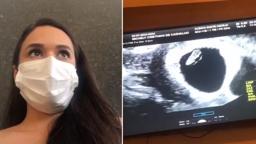 Michely Cristhian falou sobre gravidez de gêmeos e planos como bombeira