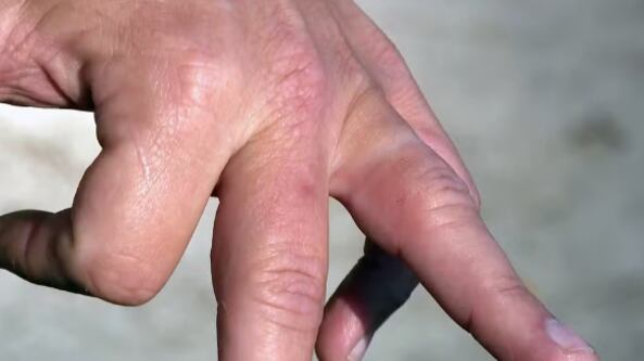 Bandidos tentam roubar carro, não conseguem e arrancam anel de vítima com os dentes