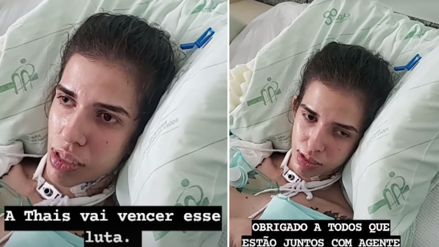 Jovem trata uma infecção nos ossos