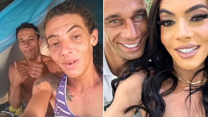 Casal 'Maloka' celebra novo sorriso após ganhar tratamento — Foto: Reprodução/Redes Sociais