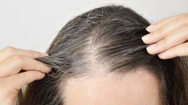 Reprodução/Pixabay