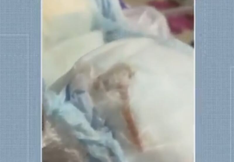 Rato encontrado em fralda.