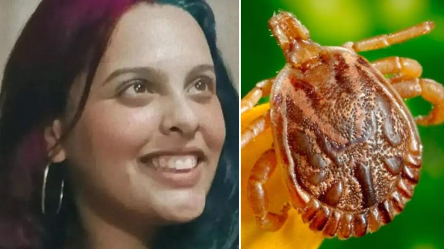 Instituto Adolfo Lutz confirmou a causa da morte dela