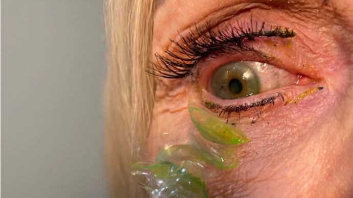 Mulher esquecia de tirar os itens para dormir