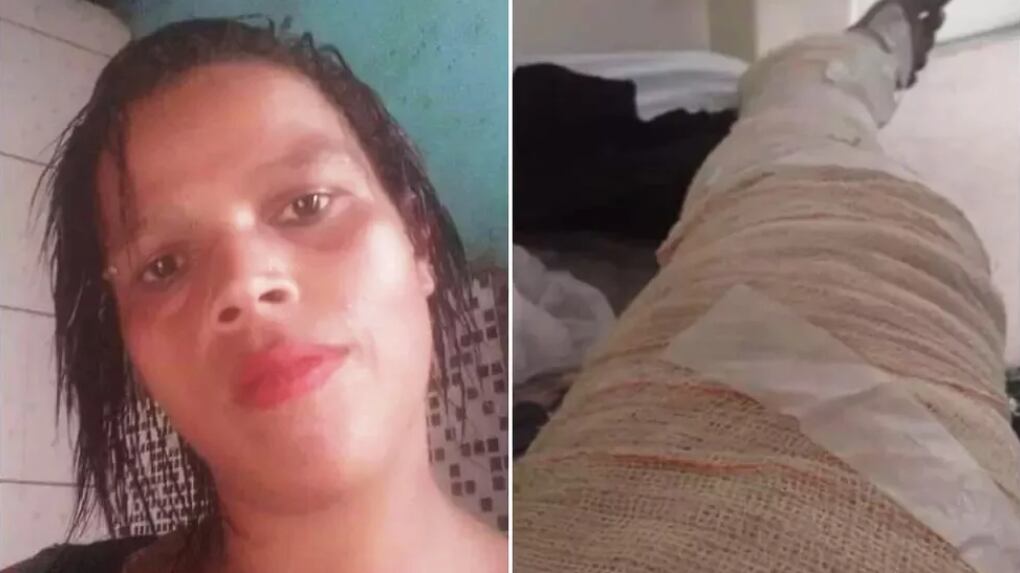 Jovem não tinha dinheiro para comprar gás