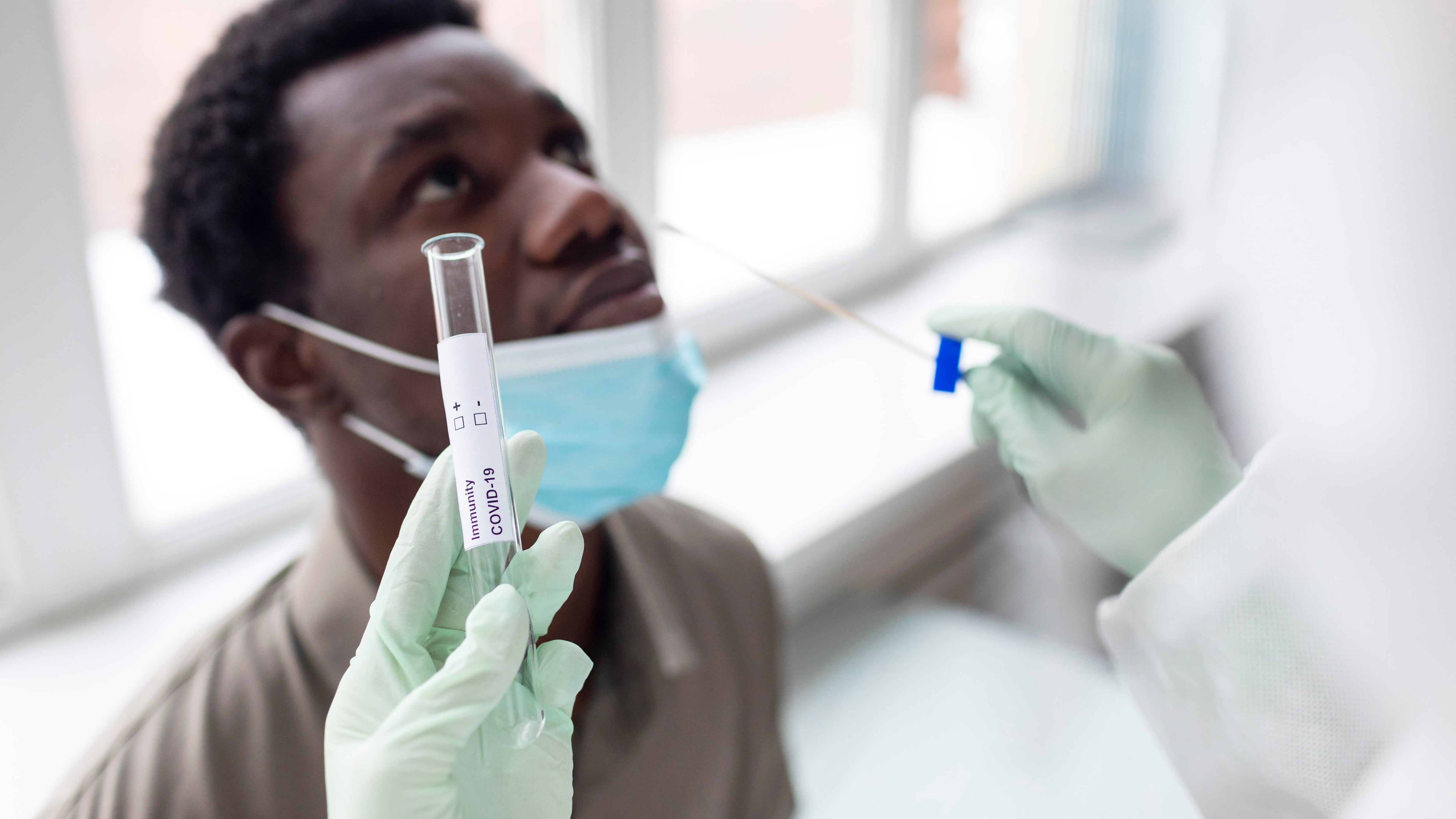 Prefeitura de SP começa a fazer teste rápido de covid-19