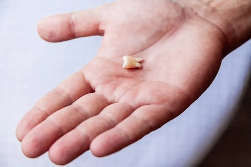 Um adesivo de microagulhas capaz de regenerar dentes foi desenvolvido na Coreia do Sul