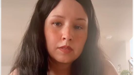 Artista plástica Shannyn Palmer sofreu queimaduras nos dedos