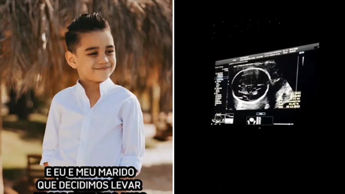 Reação de menino durante ultrassom viraliza nas redes sociais