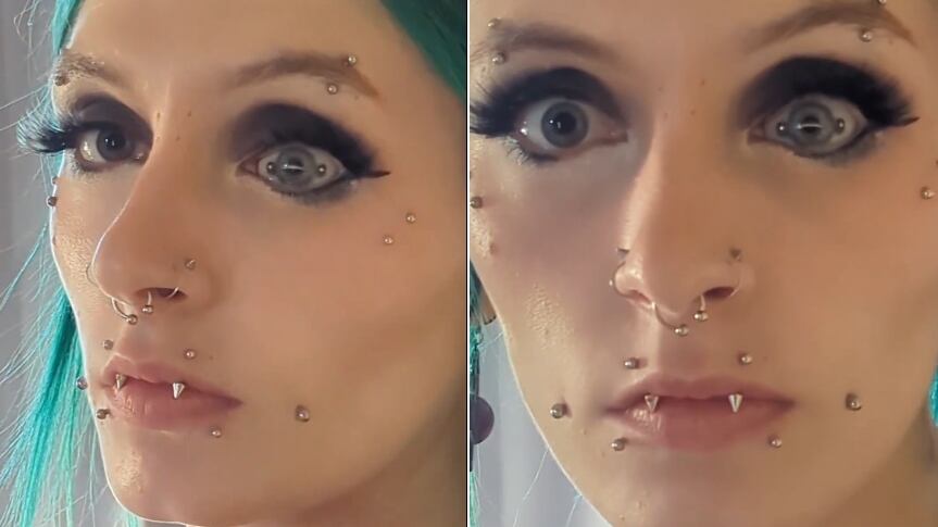 Piercing no globo ocular na verdade é protese