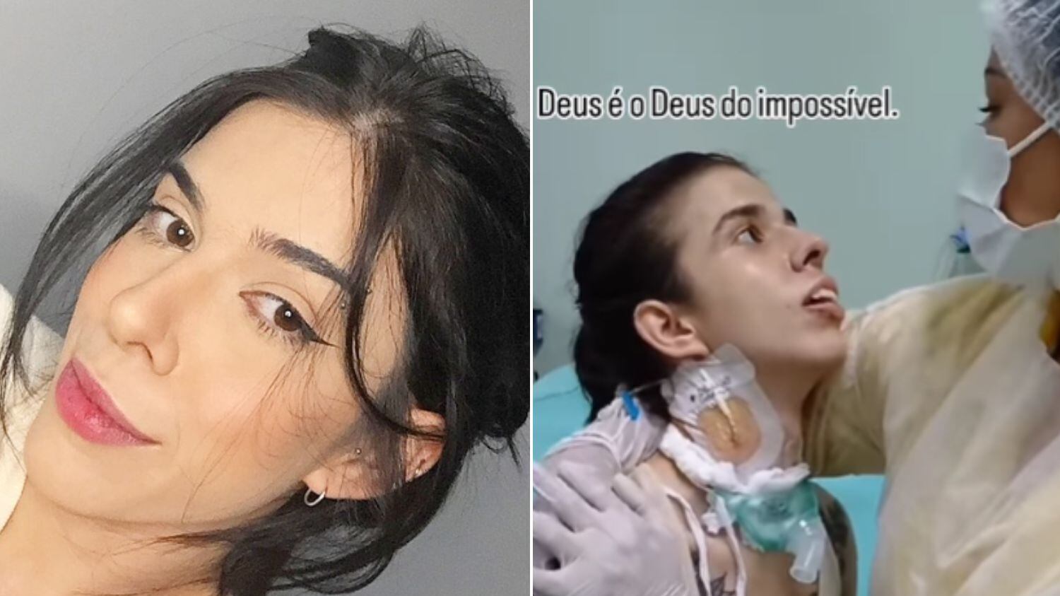 Trancista segue internada em Goiânia