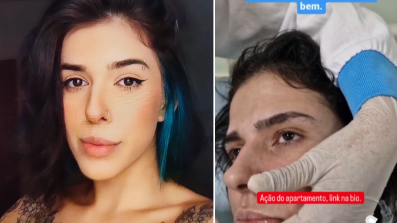 Jovem sofreu danos neurológicos após reação à pimenta