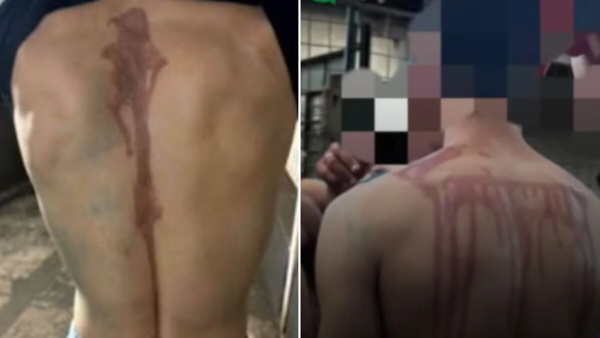 Polícia Civil investiga o caso