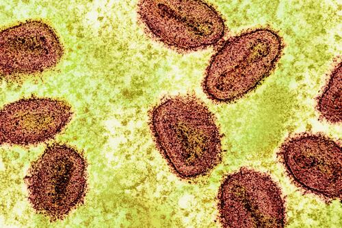 Mpox: imigrante retido no Aeroporto de Guarulhos é isolado em hotel após suspeita de contaminação