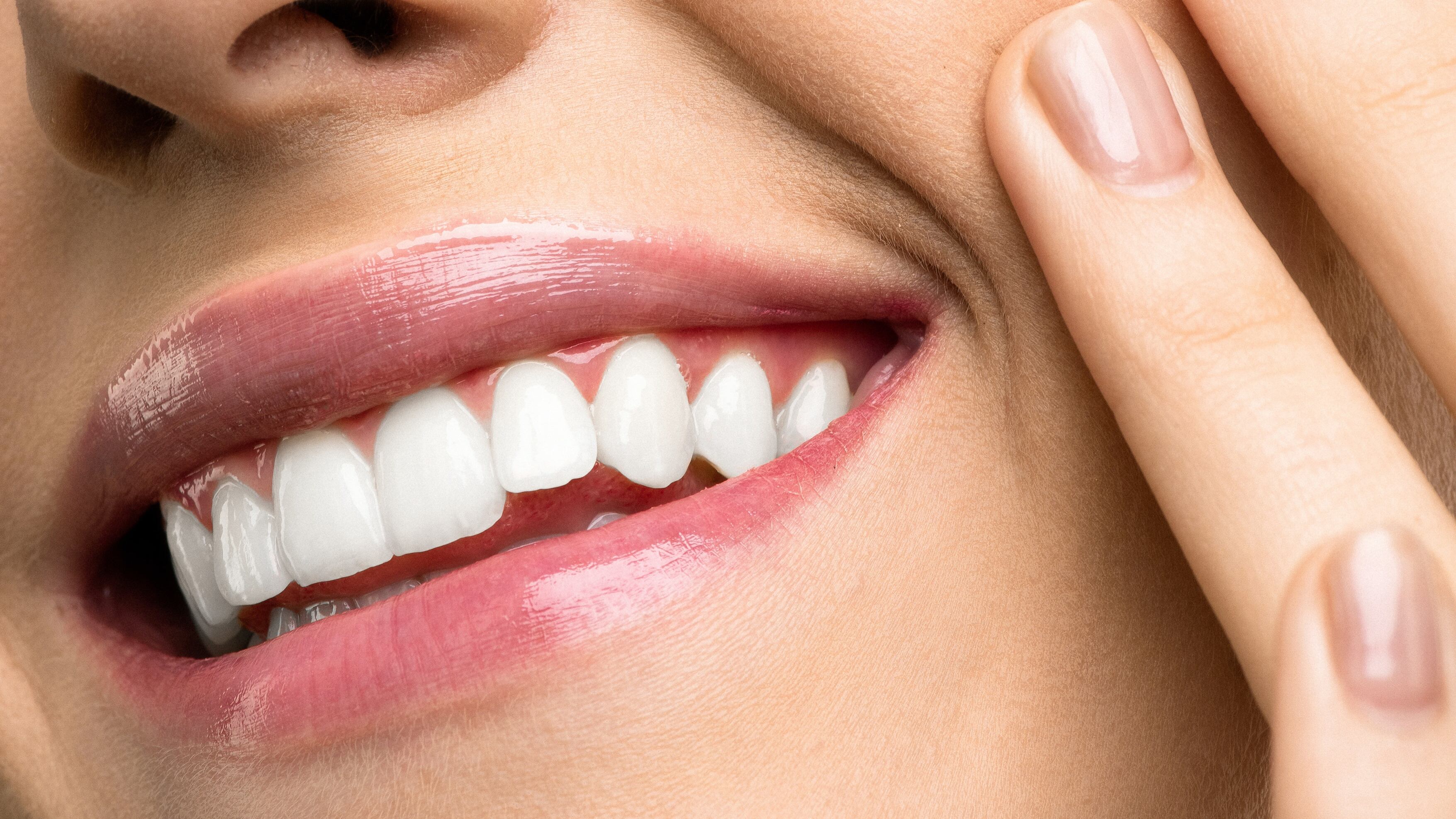 Lentes de contato nos dentes: saiba como é feita a aplicação