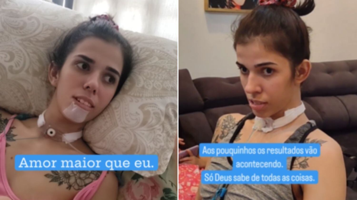 Jovem teve reação ao cheirar pimenta e quase morreu