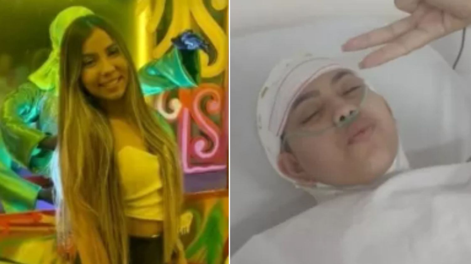 Jovem foi escalpelada em kart no DF