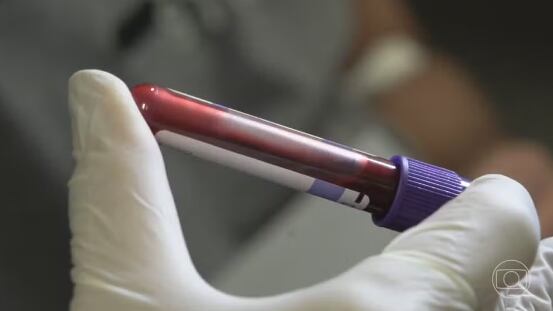 Polícia apura como foi feita a contratação de laboratório, que emitiu laudos errados