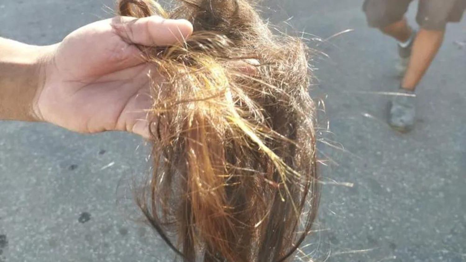 Ela sofreu vários cortes e está internada