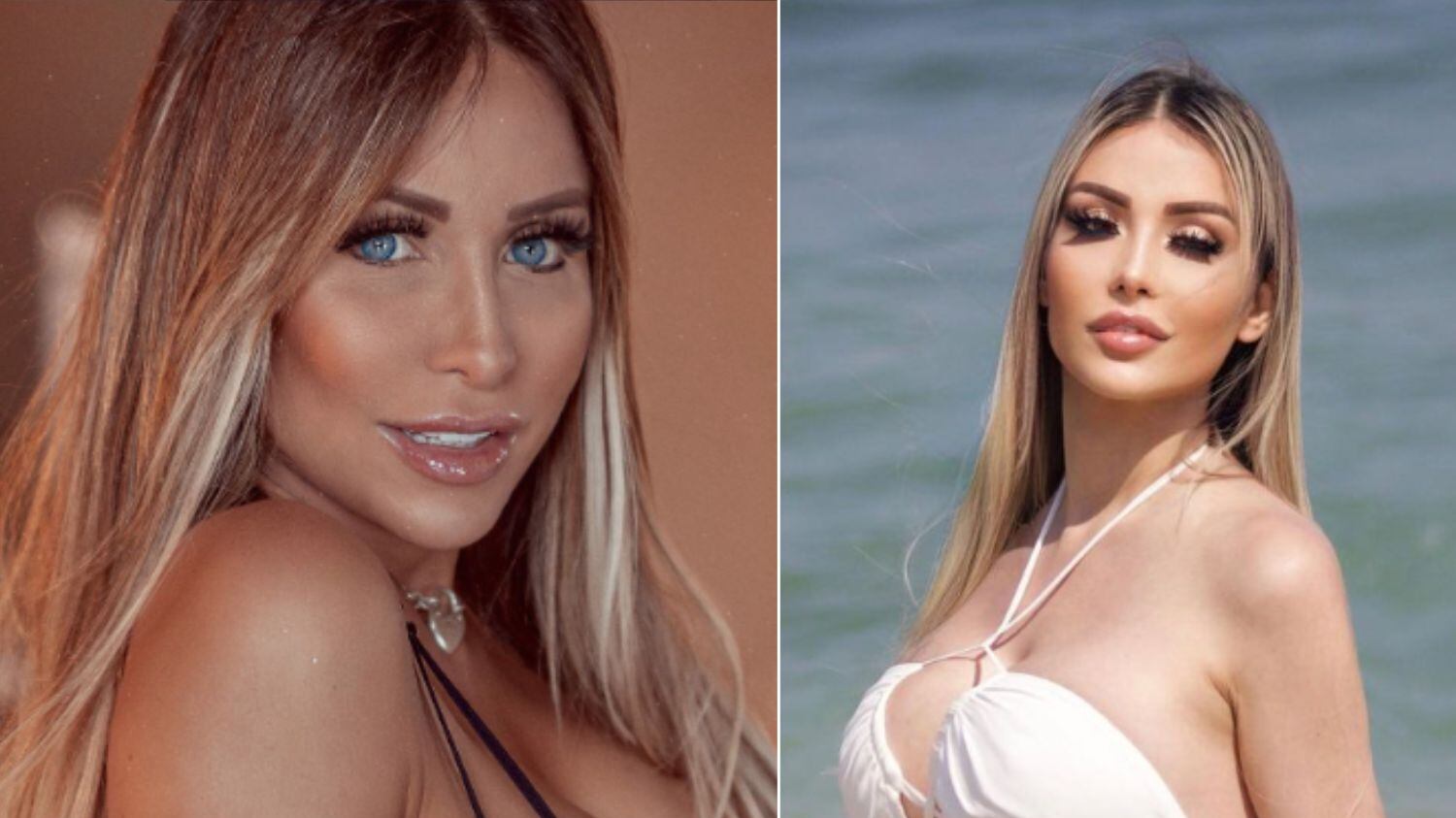 Ela era conhecida por ter tirado 3kg de silicone industrial do corpo