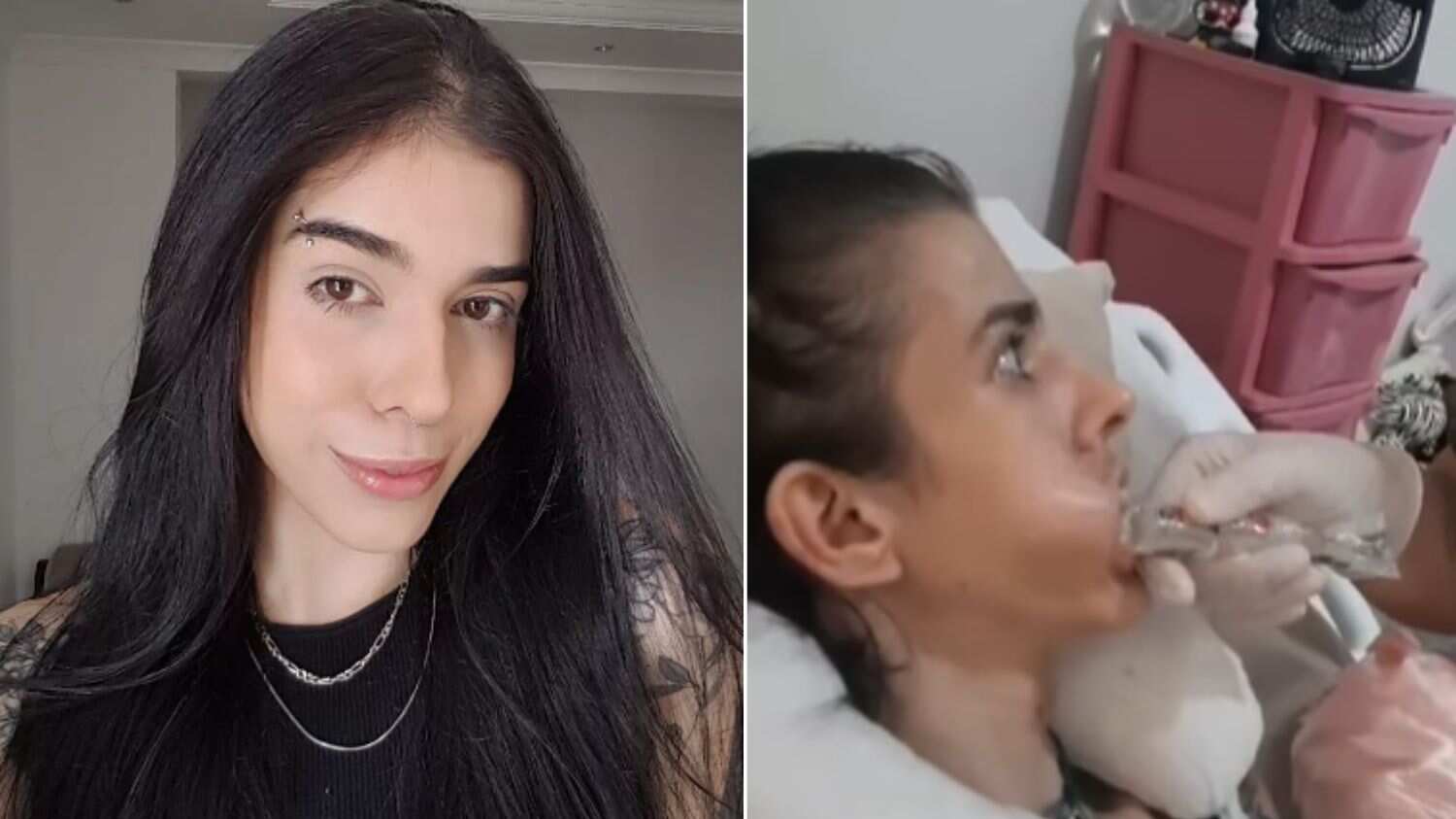 Gatilho teria sido uma reação à pimenta