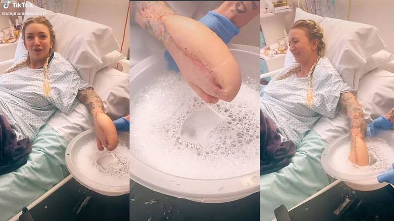 Mulher repercute nas redes por ter ‘mão de tubarão’