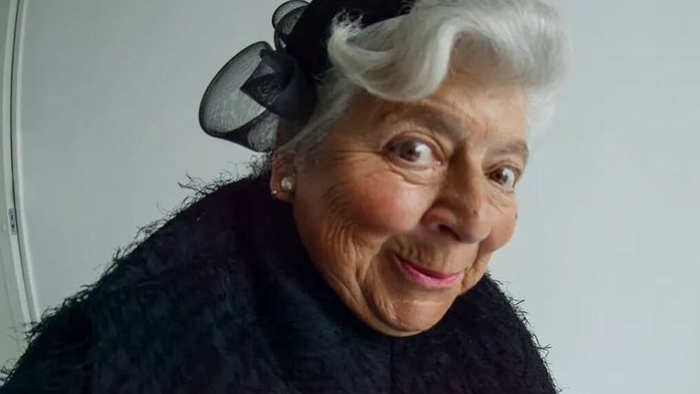 Atriz de Harry Potter passou por cirurgia e agora possui 'coração de vaca'