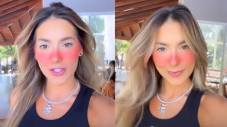 "Parece que ela tomou uma chinelada", comentou uma seguidora.
Imagem: @virginia