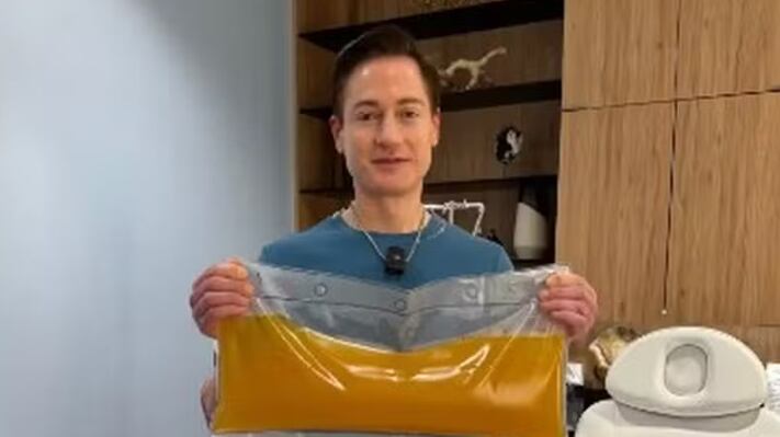 Magnata aposta em troca de plasma para reverter o envelhecimento