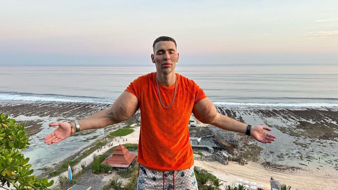 Após uma semana hospitalizado, ‘Popeye russo’ volta a exibir braços nas redes sociais