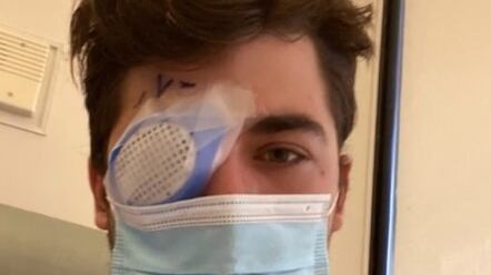 Jovem teve córnea 'comida' por parasita