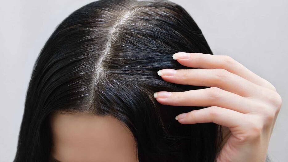 Combate ao cabelo branco/ reprodução