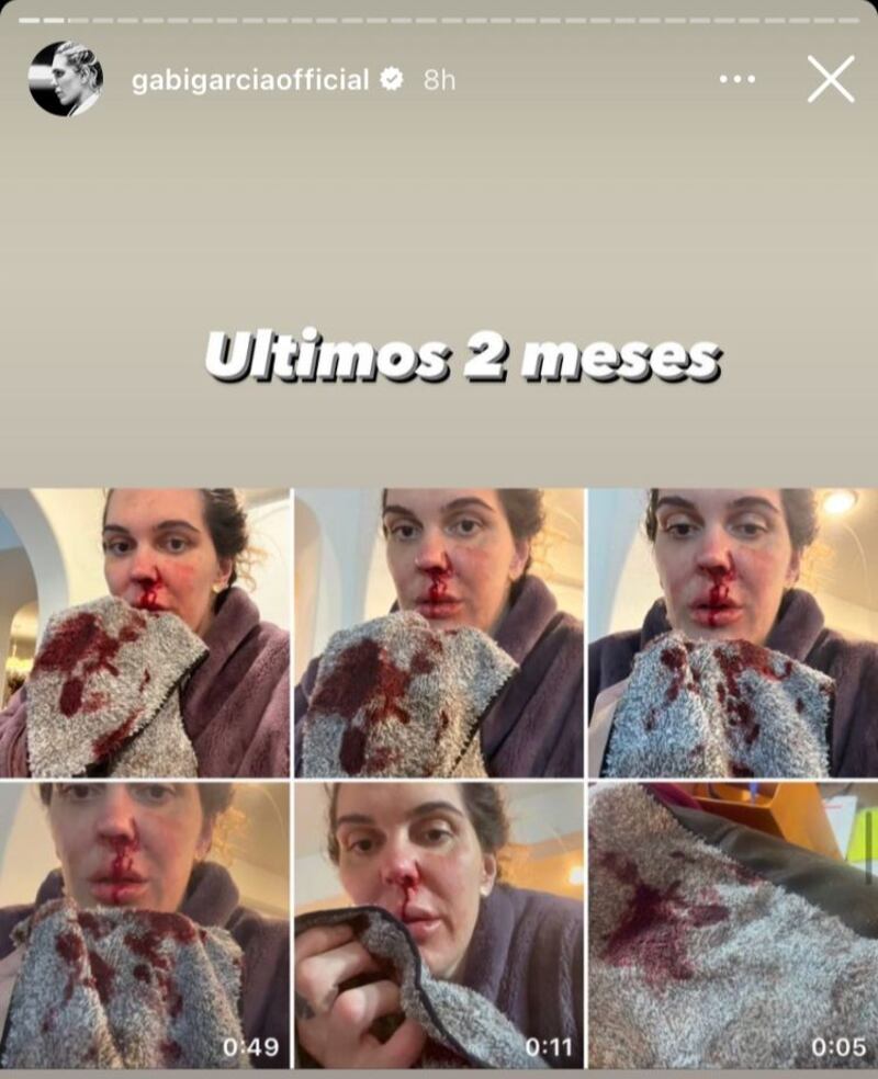 Lutadora de jiu-jitsu mostra agressões sofridas pelo ex-marido