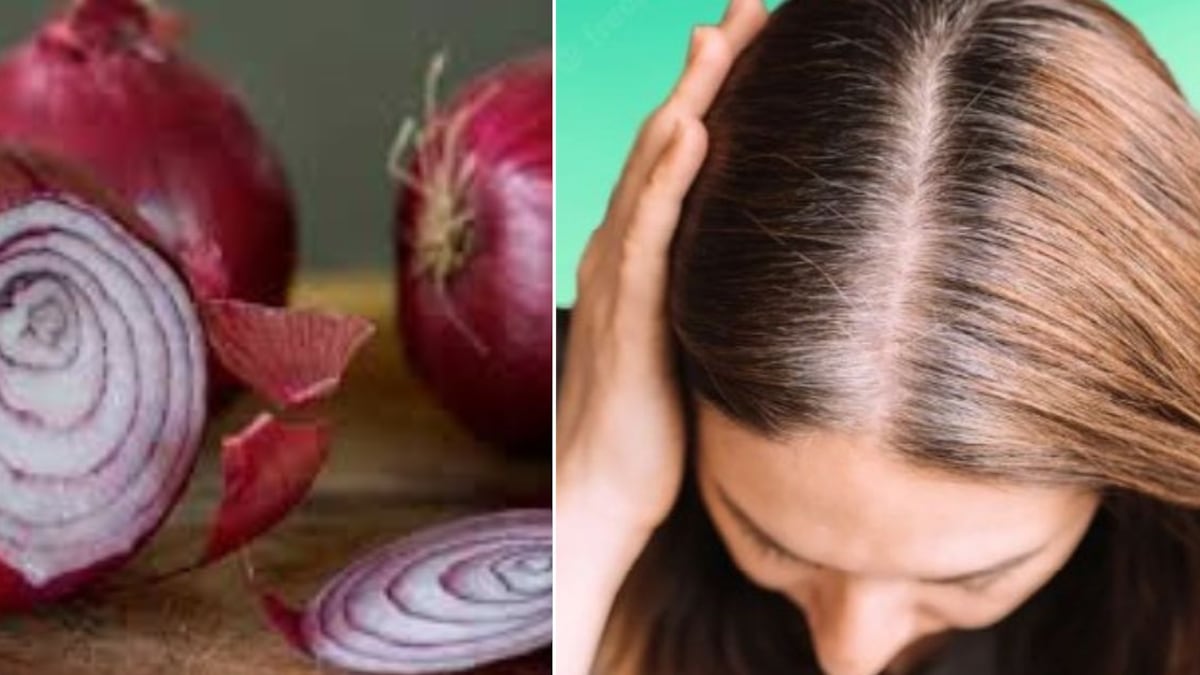 Cebolla para las canas: el remedio natural y casero para eliminarlas