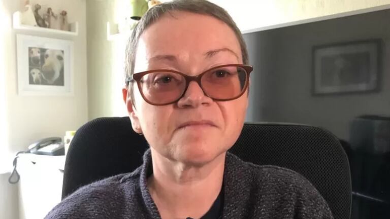 Debbie Schwartz é diagnosticada com doença tão rara que não tem nome