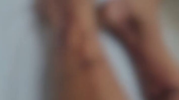 Menino teve ferimentos graves nas pernas.