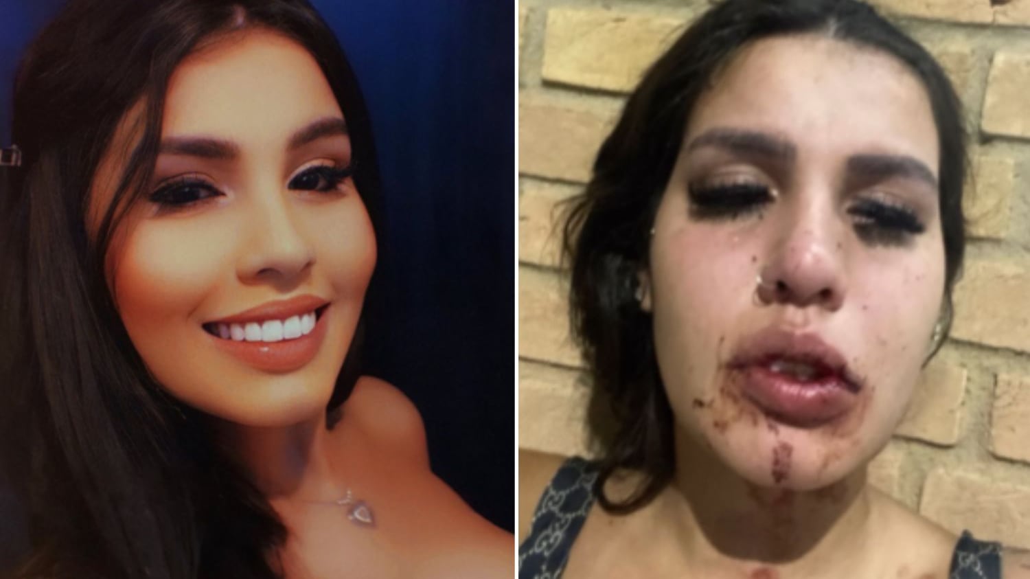 Jovem diz que ela e uma amiga foram dopadas, estupradas e agredidas