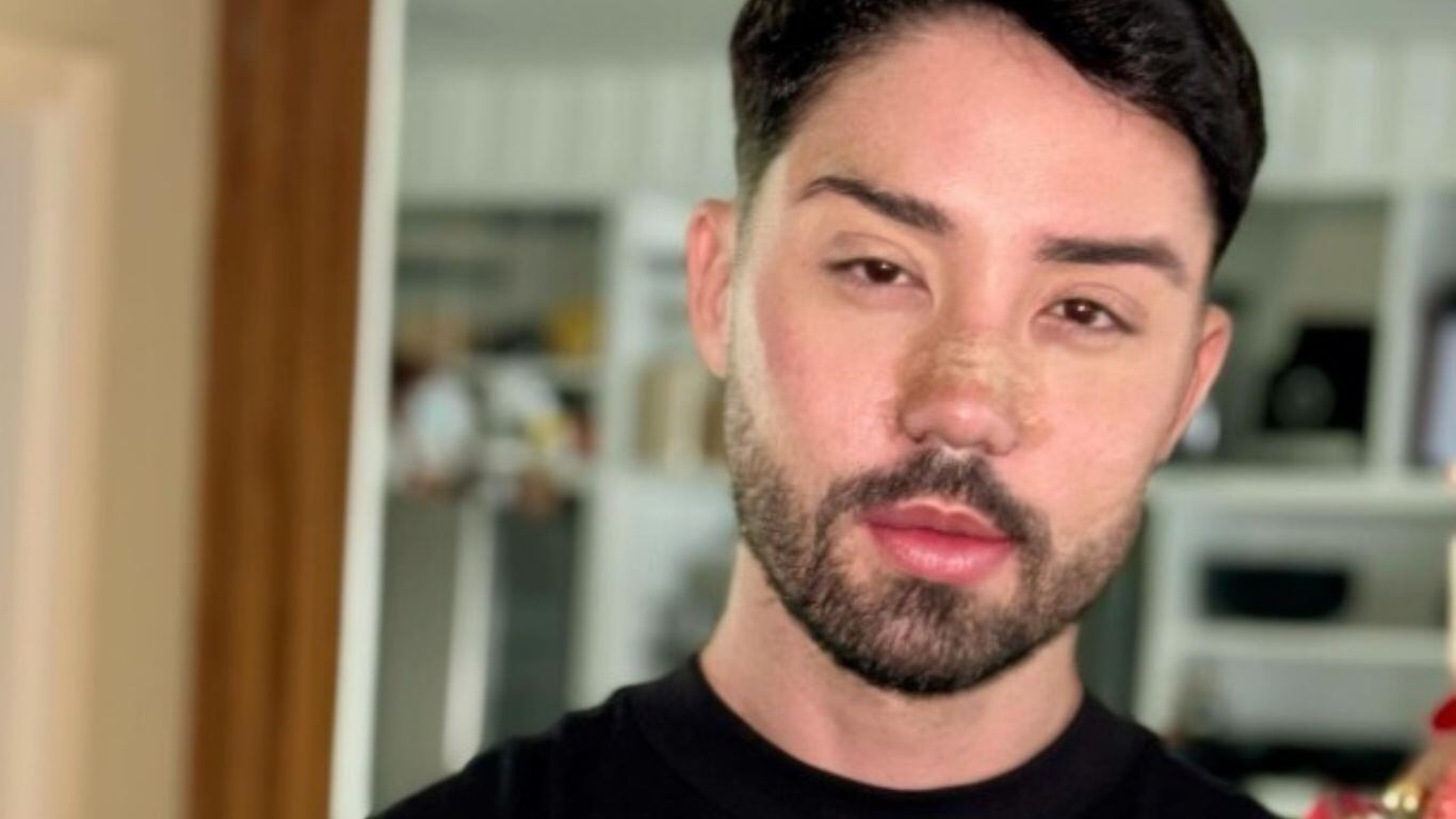 Rico Melquiades, campeão de A Fazenda 13, revela detalhes sobre os procedimentos estéticos em seu rosto