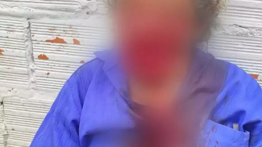 Idoso sofreu ferimentos graves.