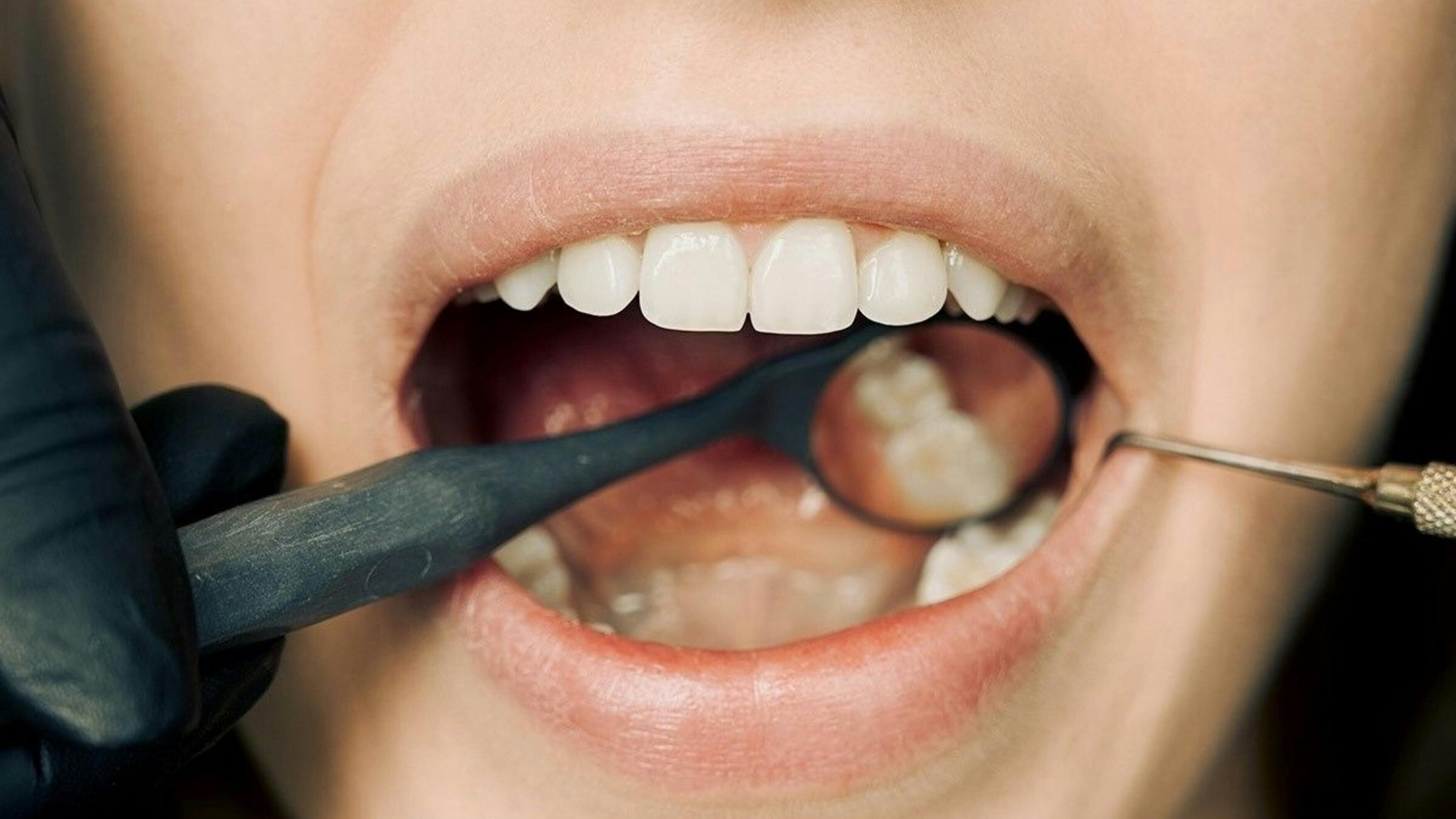 Boca feminina no dentista