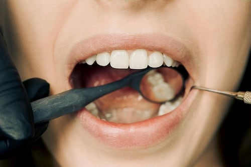 Significado dos sonhos: o que significa sonhar com dentes caindo?