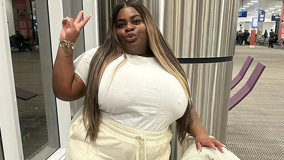 Jojo Todynho faz cirurgia bariátrica, que foi adiada