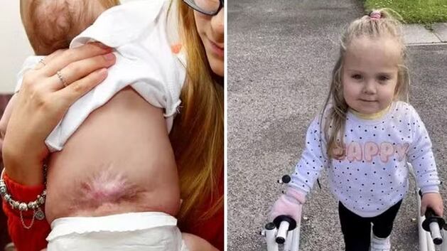 Piper-Kohl Kelly foi operada ainda no útero da mãe