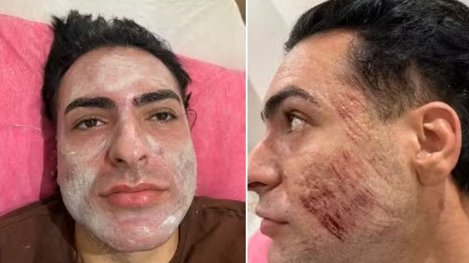 Polícia Civil investiga o caso