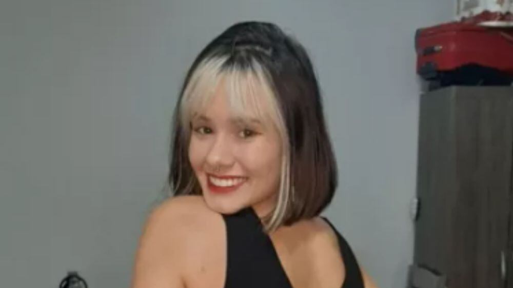 Jovem faz sucesso por habilidade incomum de virar o pescoço