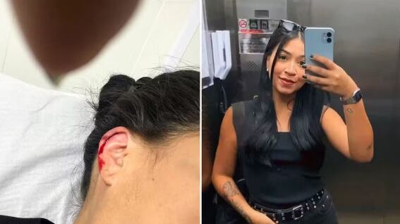 Vítima sofreu um corte na orelha